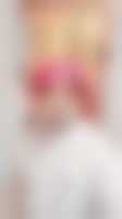صورة العضو