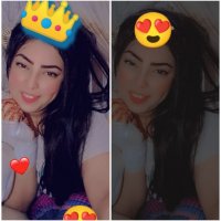صورة العضو
